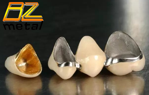 titanium in dental implant.jpg